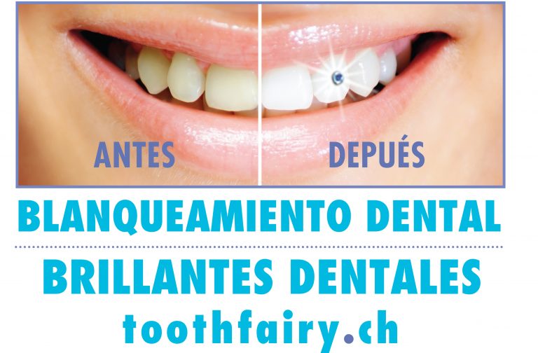 Lee más sobre el artículo <strong>Blanqueamiento dental con Tooth Fairy en Beauty Valencia</strong>